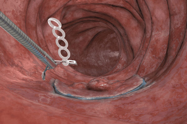 SureTrac_S1_Technik_2-600x400