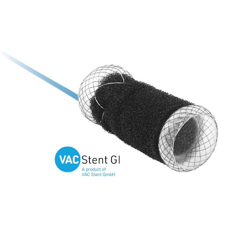 VAC-Stent-Colon-DE-800x800-1
