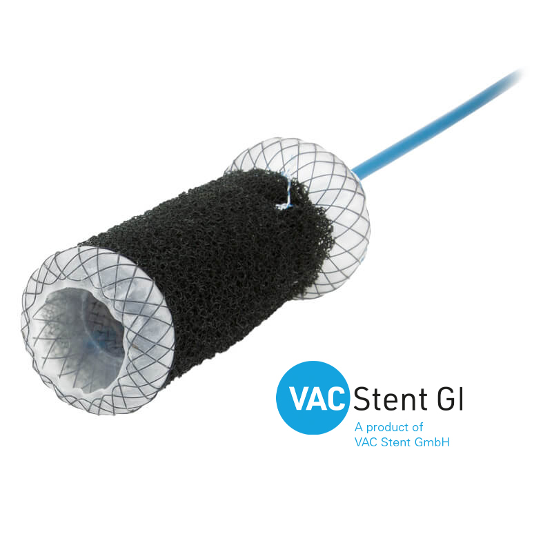 VacStent-GI_800x800_NL